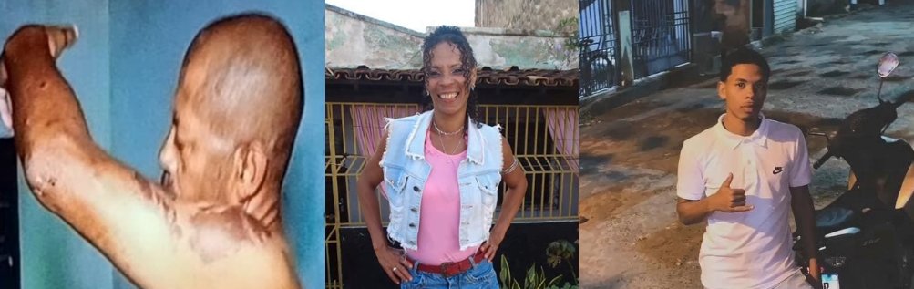 Mãe e filho atingidos por ácido em Itabuna são transferidos para o HGE; vítima perde a visão
